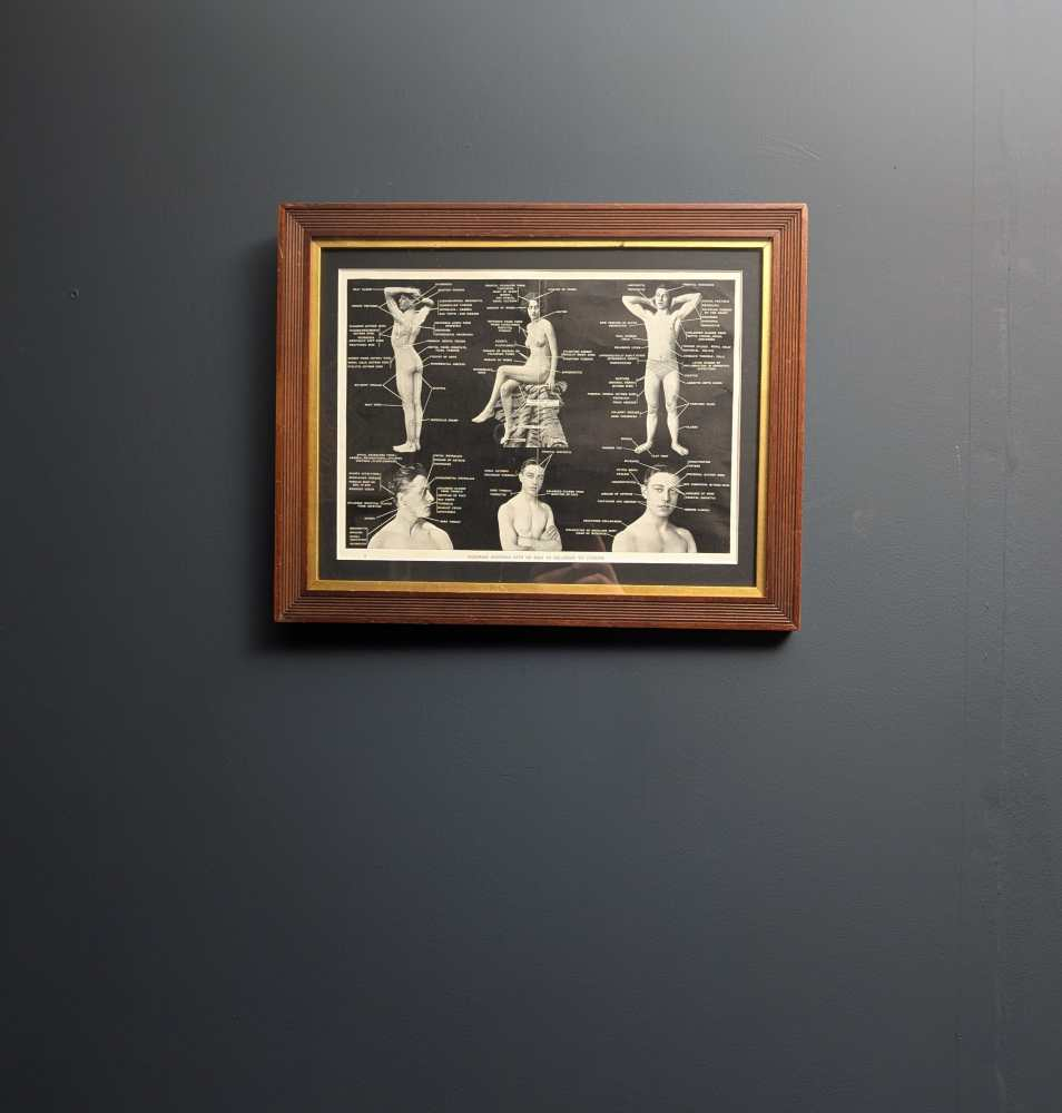 Early 1900s medical diagram with nude patients in antique wooden frame - Image 17