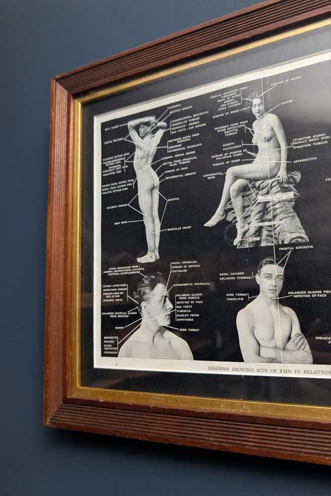 Early 1900s medical diagram with nude patients in antique wooden frame - Image 14