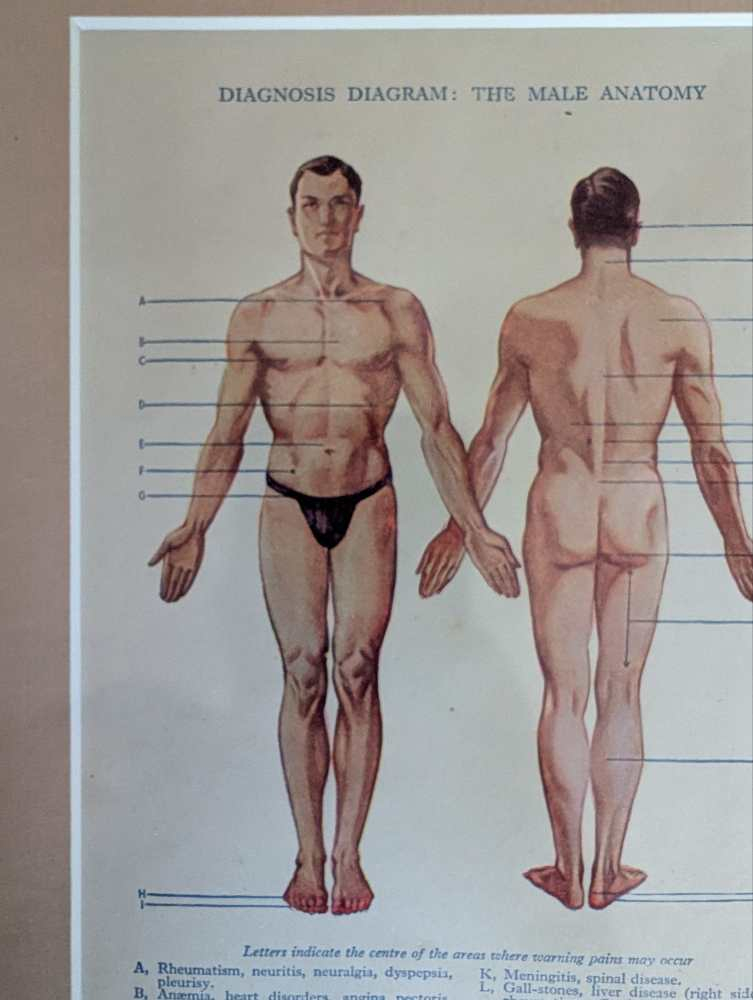 Early 20th century pair of male and female medical diagnosis diagrams of patients labelled with symptoms - Image 2