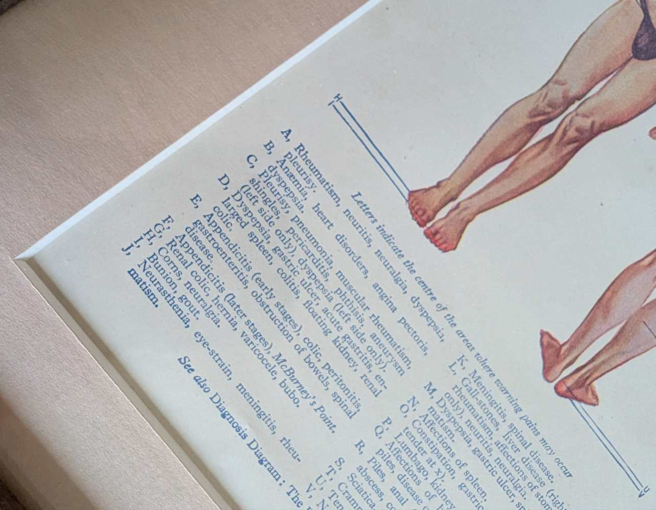 Early 20th century pair of male and female medical diagnosis diagrams of patients labelled with symptoms - Image 3