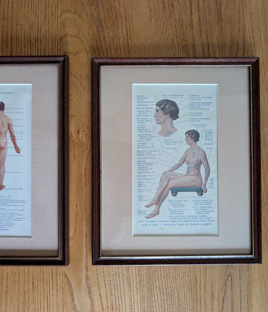 Early 20th century pair of male and female medical diagnosis diagrams of patients labelled with symptoms - Image 8