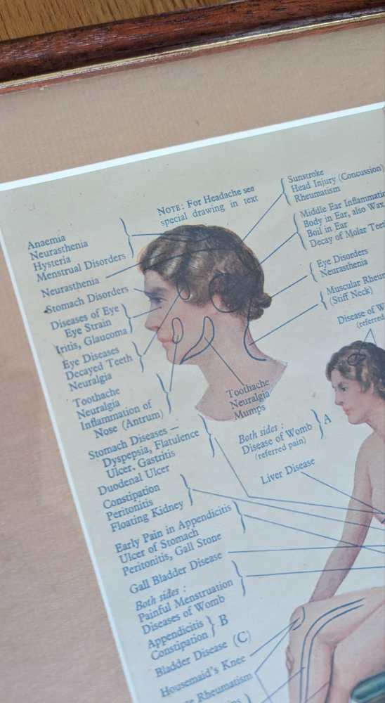 Early 20th century pair of male and female medical diagnosis diagrams of patients labelled with symptoms - Image 6