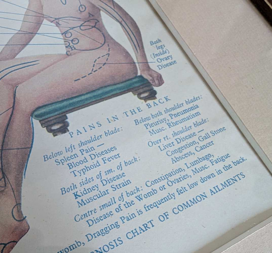 Early 20th century pair of male and female medical diagnosis diagrams of patients labelled with symptoms - Image 9