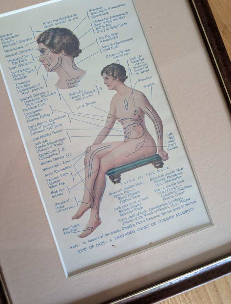 Early 20th century pair of male and female medical diagnosis diagrams of patients labelled with symptoms - Image 5