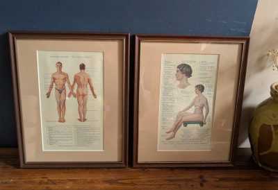 Early 20th century pair of male and female medical diagnosis diagrams of patients labelled with symptoms