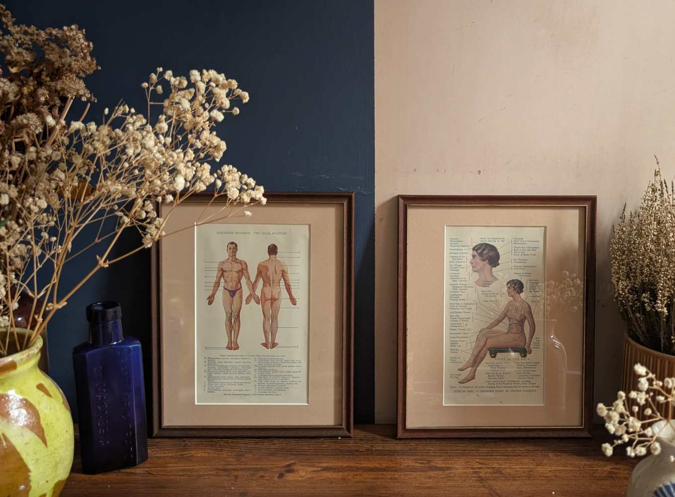 Early 20th century pair of male and female medical diagnosis diagrams of patients labelled with symptoms - Image 4