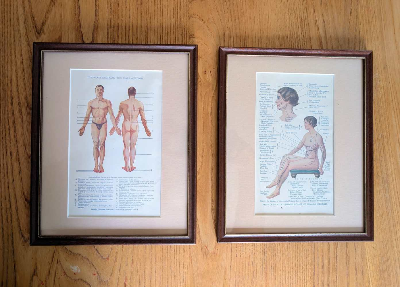 Early 20th century pair of male and female medical diagnosis diagrams of patients labelled with symptoms - Image 10
